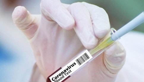 Kiedy szczyt zachorowań na koronawirusa w Polsce? Są kolejne prognozy