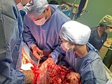 [FOTO] Usunęli pacjentce guza, który ważył 20 kg! Uwaga! Drastyczne zdjęcia 